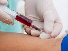Get Full Blood Count Test Only From 148
