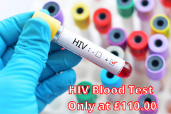 Perform Hiv Blood Test Only At 110