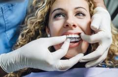 Get Invisalign Treatment In London With Great Di
