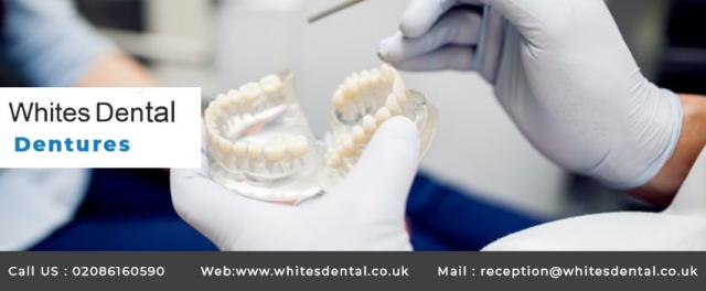 Teeth Whitening London Bridge 3 Image
