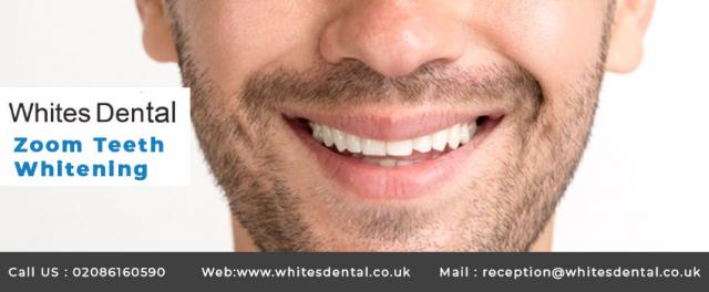 Philips Zoom Teeth Whitening 4 Image