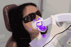 Brighten Your Smile Instantly With Zoom Teeth Wh