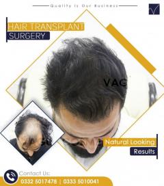 Dr Rana Irfan Hair Transplant