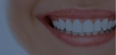 Teeth Alignment  Tmj Treatments - Simply Teeth E