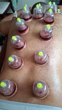 Complete Hijama Business & Practitioner Mastercl