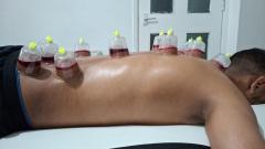 Certified Hijama Cupping Training Course Uk