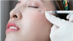 Achieve Desired Look With Dermal Fillers And Bot