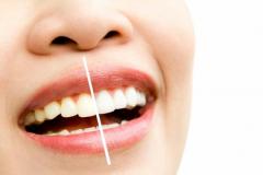 Zoom Teeth Whitening Treatment At Carnaby Laser 