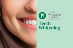 Professional Teeth Whitening Services Across Lon