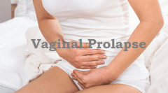 What Is Vaginal Wall Prolapse