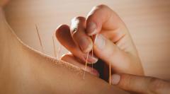Need For Acupuncture Treatments In Street Liverp