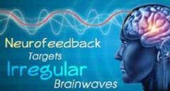 Neurofeedback Training For Top Counselors