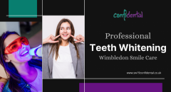 Professional Teeth Whitening Wimbledon Smile Car