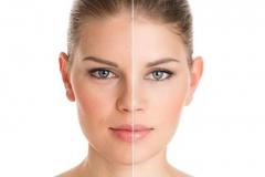 Improve Your Facial Appearance And Confidence Wi