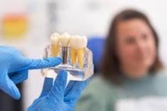 Whitton Dental Excellence  Implants, Whitening &