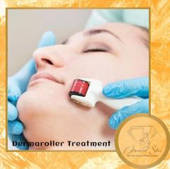 Dermaroller Treatment London - Diamond Skin Aest
