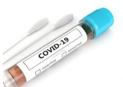 Covid Test Kits Services  Nx Healthcare
