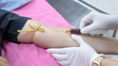 Ivf Blood Test & Surrogacy Screening Leeds