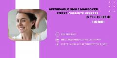 Affordable Smile Makeover Expert Composite Venee