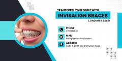 Transform Your Smile With Invisalign Braces  Lon