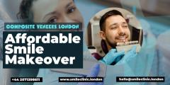 Composite Veneers London - Affordable Smile Make