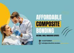 Affordable Composite Bonding  Natural Smile Make