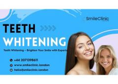 Teeth Whitening  Brighten Your Smile With Expert