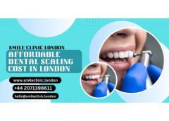 Affordable Dental Scaling Cost In London  Smile 
