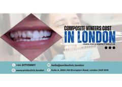 Composite Veneers Cost Guide For A Perfect Smile