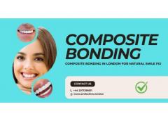 Composite Bonding In London For Natural Smile Fi