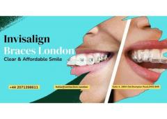 Invisalign Braces London  Clear & Affordable Smi