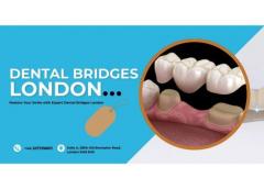 Restore Your Smile With Expert Dental Bridges Lo