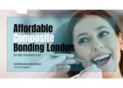 Affordable Composite Bonding London  Smile Makeo