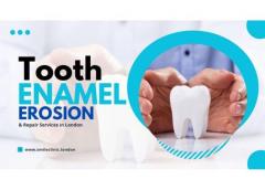 Tooth Enamel Erosion & Repair Services In London