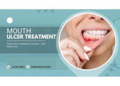 Mouth Ulcer Treatment In London - Fast Relief Ca