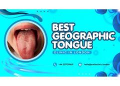 Best Geographic Tongue Clinic In London, Smile C