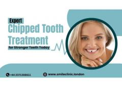 Expert Chipped Tooth Treatment For Stronger Teet