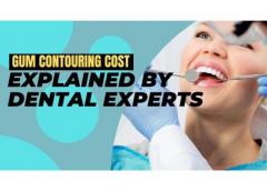 Gum Contouring Cost Explained By Dental Experts