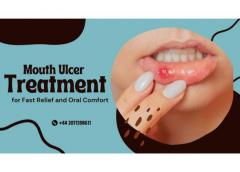 Mouth Ulcer Treatment For Fast Relief And Oral C