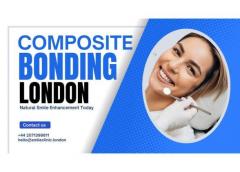 Composite Bonding London  Natural Smile Enhancem