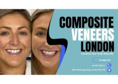 Composite Veneers London  Transform Your Smile N