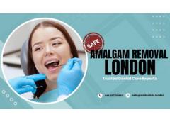 Safe Amalgam Removal London  Trusted Dental Care