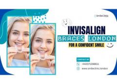 Invisalign Braces London For A Confident Smile