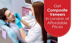 Get Composite Veneers In London At Affordable Pr