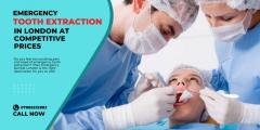 Emergency Tooth Extraction In London At Competit