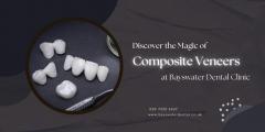 Discover The Magic Of Composite Veneers At Baysw