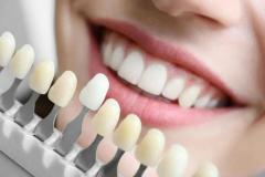 Shine Your Teeth - Best Treatment Of Bleaching T