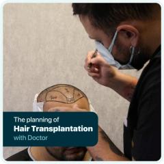 Hair Transplant In Turkey - Cosmeticium