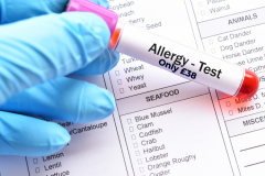 Get Accurate Allergy Testing In London From 38