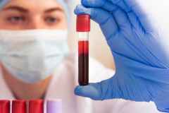 Get Accurate Results With Private Blood Tests At